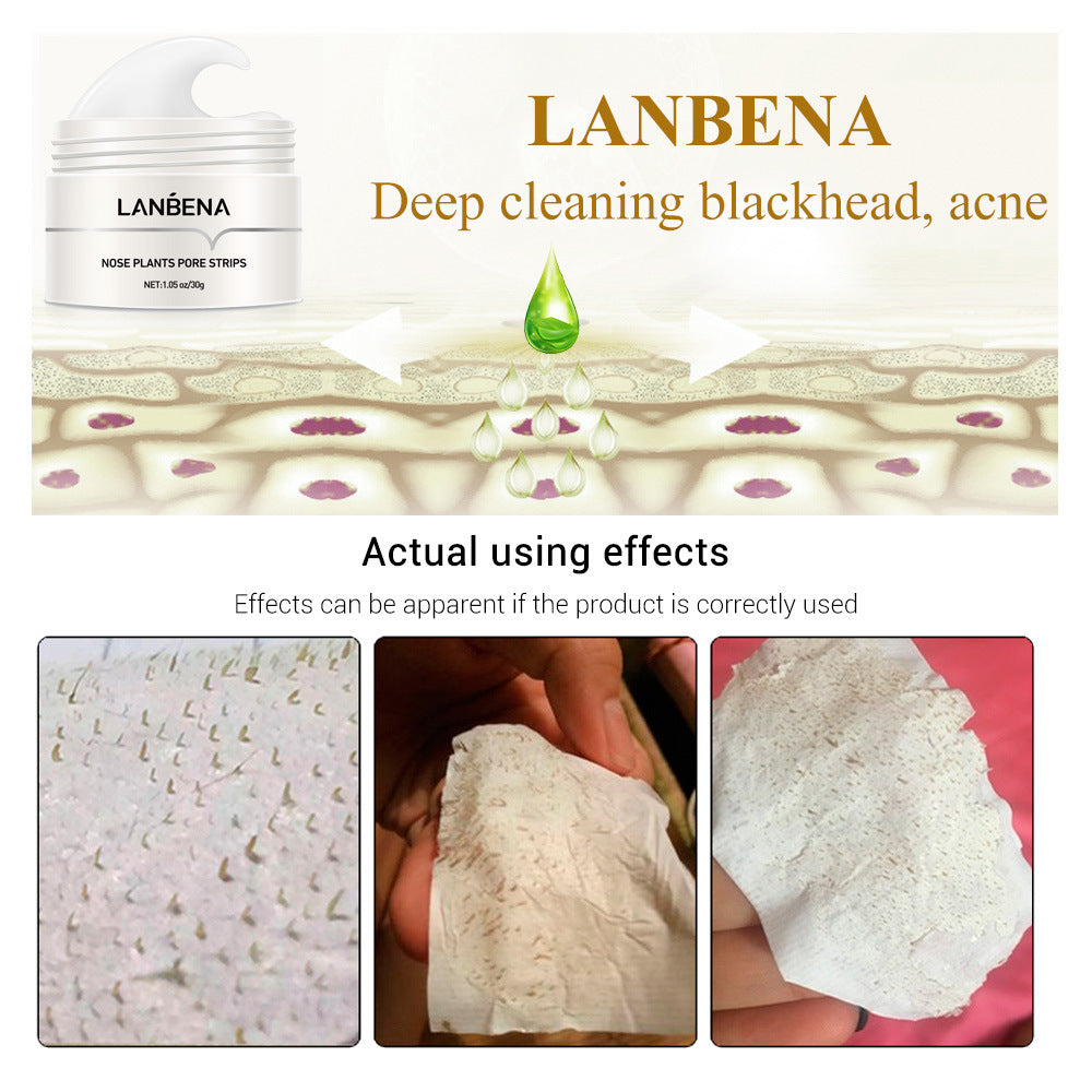 Blackhead Nasal Membrane